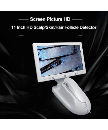 Hair Follicle Detector 11 Inch 200X High-Definition Skin Detector 1080P Imaging Used to Detect the Health Status of Scalp Hair Follicles and Skin - Buy Online on GoSupps.com