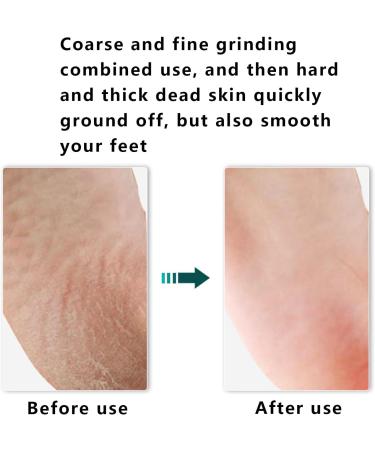 Premium Foot Rasp & Callus Remover - Best Foot Care Tool for Smooth Feet | Wet & Dry Use Durable Wood Design - Buy Online on GoSupps.com