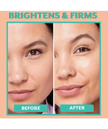 Patchology Serve Chilled Bubbly Eye Gels with Niacinamide - Hydrating Under Eye Patches for Dark Circles, Puffy Eyes, and Fine Lines - 5 Pairs - Buy Online on GoSupps.com