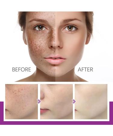Lot de 3 cr mes pour Las Manchas de La Cara Cremas para Quitar Manchas de La Cara Crema Blanqueadora para Pecas Elimina el Melasma Manchas Oscuras Aclara La Piel - Buy Online on GoSupps.com