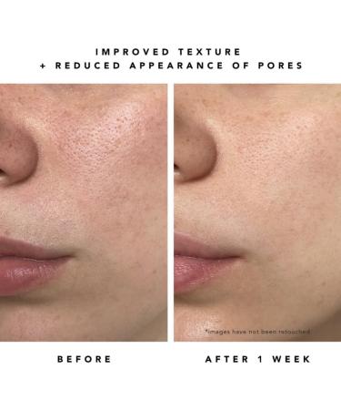 HERBIVORE Milky Way Exfoliating Serum 10% AHA | Vegan Cruelty-Free Glow Formula with Ceramides & Hyaluronic Acid | International Shipping 30mL - Buy Online on GoSupps.com