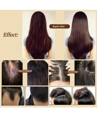 Ginger Germinal Oil Hair Growth Essence Oil Ginger Germinal Essential Oil Hair Loss Treatment Hair Care Hair Growth Serum Promotes Thicker Hair Regrowth For All Hair Types (1PC) - Buy Online on GoSupps.com