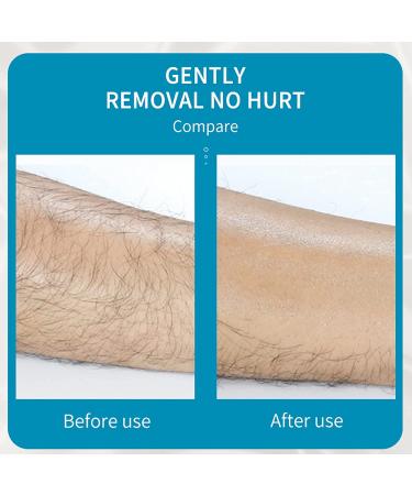 Crystal Hair Eraser  ANTAND Bleam Crystal Hair Remover Magic Painless Exfoliation Hair Removal Tool for Women Men Leg Arm Back  Eco-Friendly Reusable Crystal Hair Eraser for Soft Smooth Skin Gold - Buy Online on GoSupps.com