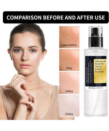 Snail Mucin Essence Snail Repair Face Serum Niacinamide Serum Snail Facial Serum Snail Hydrating Serums Snail Hyaluronic Acid Essence Face Skin Care Snail Essence Improve Dull Skin Essence 100ML - Buy Online on GoSupps.com