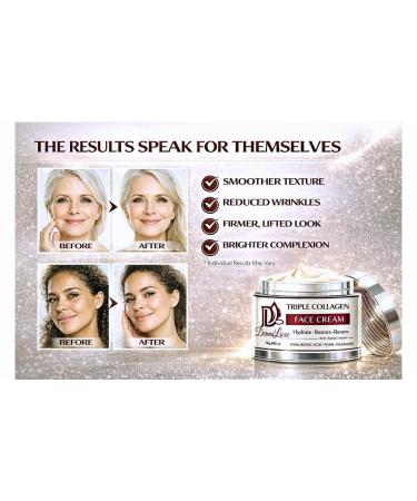 DermaLuxe Anti-Aging Collagen Face Cream-PDRN Salmon DNA, Hyaluronic Acid & Niacinamide-Hydrating, Firming, Lifting Wrinkle Repair Moisturizer-K Beauty Skincare Glow Day & Night-All Skin Types 1.7 oz - Buy Online on GoSupps.com