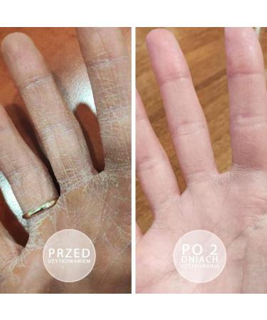 BEAUTICA S.O.S. Intensively oily ointment with vitamin E 100ml - Buy Online on GoSupps.com