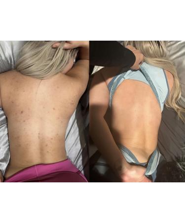 All-Natural Exfoliating Gel for Face & Body - Unisex Hypoallergenic Peeling Gel Shop Internationally - Buy Online on GoSupps.com