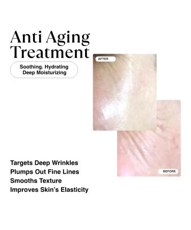 MATKAS Korean 0.05% Retinal Night Cream - Anti-Aging Face Moisturizer with Niacinamide Ceramide & Hyaluronic Acid for Wrinkles & Skin Tightening - Buy Online on GoSupps.com