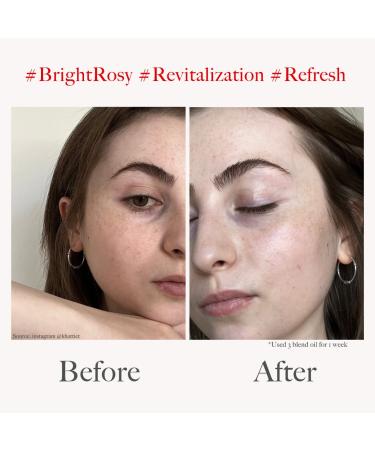 Three Blend Oil BRIGHT ROSY 1.01oz - Vegan Facial Oil for Dry Skin - Revitalizing Formula - Buy Online on GoSupps.com