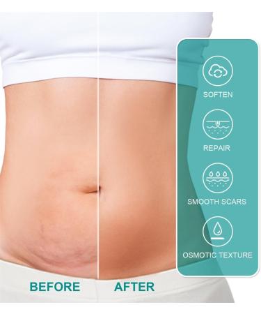 VOIV Scar Remover Spray 20g 5pcs - Relieves Itching, Removes Dark Acne - Dermatologist Recommended for All Types of Scars - Buy Online on GoSupps.com