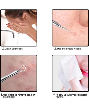 Professional Facial Milia & Whitehead Extractor Tool Set - Double Ended Pimple Extractor for Blackheads & Blemishes - 2-in-1 Acne Removal Kit (4.6in-Silver) - Buy Online on GoSupps.com