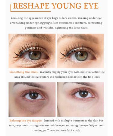 Vitamin C Eye Cream for Dark Circles & Puffiness - Advanced Anti-Aging Treatment with Hyaluronic Acid for Men & Women - Buy Online on GoSupps.com