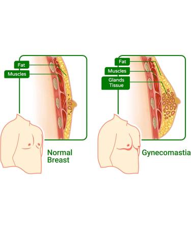 Gynecomastia Compress Patch | Male Breast Sculpting & Tightening | 24 Natural Ingredients Patches - Buy Online on GoSupps.com
