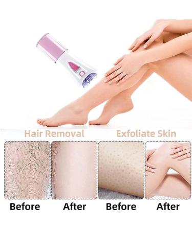 Glabrouse Skin Epilator Glabours Skin Hair Remover for Women Glabrouse Skin Epilator for Face Epilators Hair Removal for Women Face (2 pcs) - Buy Online on GoSupps.com