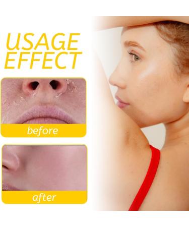 NHPY Sebum Cream For Face & BodySebaceous CreamGrassFed Beef FatNatural Honey & Beeswax MoisturizerDeep Hydration & CareOil & Fragrance FreeFast Absorbing - Buy Online on GoSupps.com