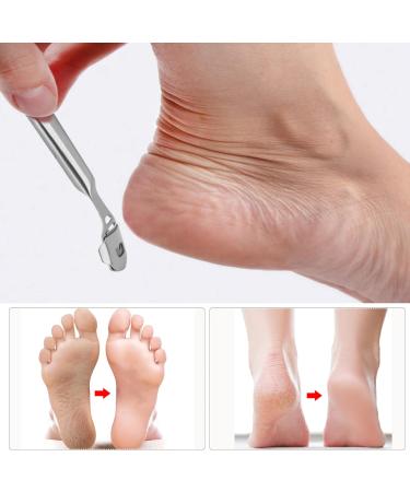 Stainless Steel Horn Skin Remover - Pedicure Tool with 10 Replacement Blades for Wet & Dry Feet | Effective Hard Skin Corneal Care - Buy Online on GoSupps.com
