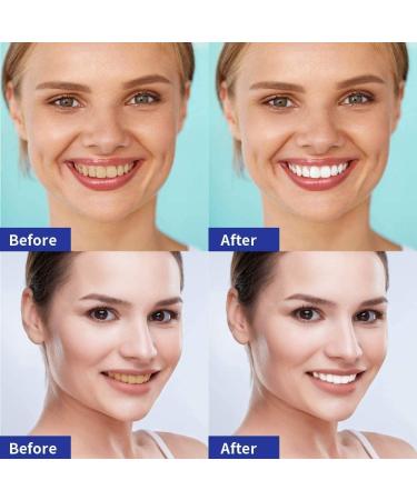 Teeth Whitening Strips 28 Strips - Effective Whitener for Sensitive Teeth - Buy Online on GoSupps.com