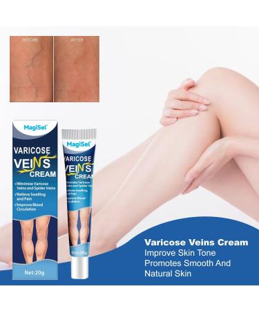  MagiSel Anti Varicose Veins Cream Varicose Veins Cream Varicose Veins Cream Varicose Veins Cream Varicose Veins Cream Varicose Veins Cream Varicose Veins Cream Varicose Veins Cream 20g - Buy Online on GoSupps.com