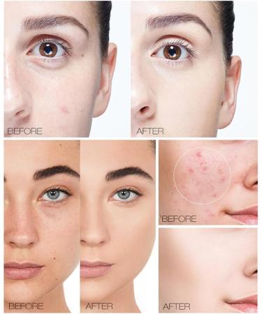 Anti-cernes pour le visage Maquillage longue dur e Oil-control Contouring Foundation Eyes Dark Circle Hydratant Cosm tique Accessoire Couleur de peau brillante - Buy Online on GoSupps.com