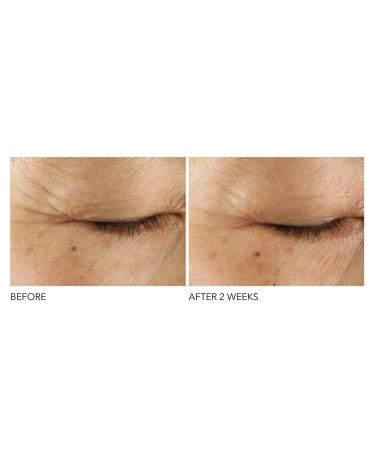 Dr. Dennis Gross Retinol + Ferulic Eye Serum for Firm Skin, Hydration, Wrinkle Reduction - 0.5 oz - Buy Online on GoSupps.com