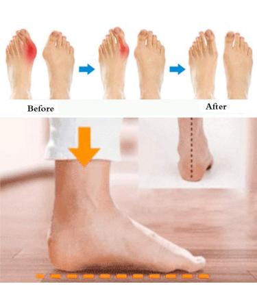 Women s Plateau Sandals - Orthopedic Bunion Corrector Clip Toe Flop Flops for Summer Travel | Leopard Pattern Size 39 EU - Buy Online on GoSupps.com