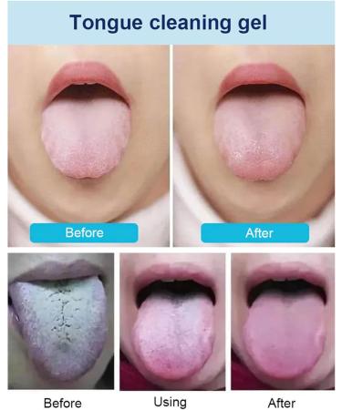 Probiotic Tongue Cleaning Gel Set & Brush - Oral Hygiene Brush & Tongue Scraper - Peach Flavor 2 Pack - Buy Online on GoSupps.com