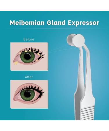 Premium Stainless Steel Meibomian Gland Expressor Forceps - Buy Online on GoSupps.com