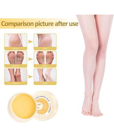 3 Pack Cracked Skin Repair Cream Anti Chapping Cream for Winter Skin Winter Cracked Hand & Foot Cream Dry Foot Ointment Cream Heel Cracks - Buy Online on GoSupps.com