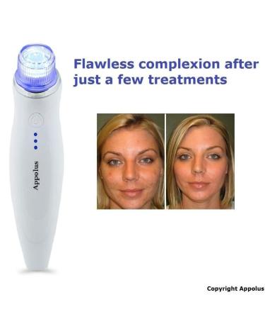 Appolus Premium Diamond Microdermabrasion Machine for Flawless Skin - 2 Diamond Tips - 5 Heads - Blackhead Blemish Remover - Pore Minimizer - Wrinkle Reduction - Sagging Skin Treatment - Silver - Buy Online on GoSupps.com