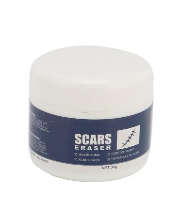 Scar Eraser Gel - Effective for Old & New Scars, Skin Repair & Removal Treatment - Buy Online on GoSupps.com