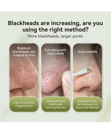LANBENA Pore Strips - 100pcs Blackhead Remover Nose Strips Effective Facial Mask for Clear Skin (50g/1.76 Oz - Buy Online on GoSupps.com
