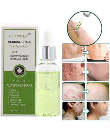 GOOPGEN Scar Repair Serum 30ml - For Acne, Stretch Marks, and Surgical Scars - Buy Online on GoSupps.com