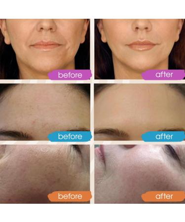 New 2024 Pure Hyaluronic Acid Serum - Hydrating & Anti-Aging Face Serum for Women | 2oz for Dry Skin & Dark Spots - Buy Online on GoSupps.com