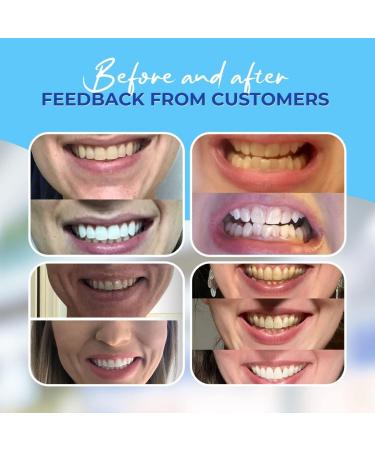 LUELLI Teeth Whitening Strips - 7-Day Whitening Kit - 10 Shades Whiter - 14 Treatments - Buy Online on GoSupps.com