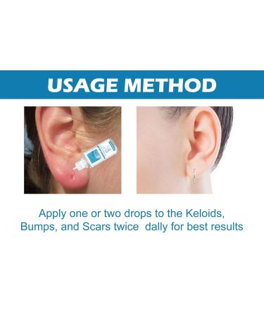 Natural Piercing Base Solution | Gentle Cleaner for Ear Abdominal & Nose Piercings - Effective for Scars Nodules & Stains - Buy Online on GoSupps.com