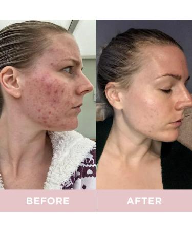 Revive Collagen Premium Hydrolyzed Marine Collagen Drink for Women 8 500MG with Hyaluronic Acid Aloe Vera Juice Revive Skin Health Hydration Hair & Skin Lemon & Lime Flavour 14 Sachets - Buy Online on GoSupps.com