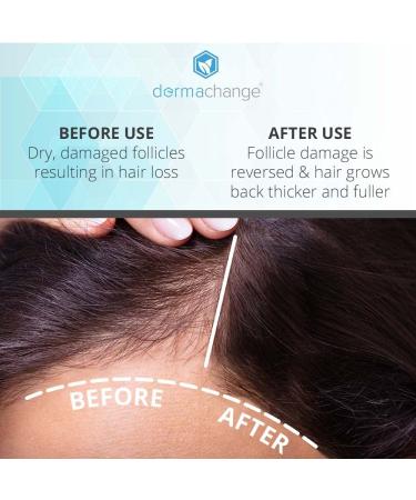 Organic Hair Growth Conditioner for Women and Men - Sulfate-Free - Prevent Hair Loss & Dermatitis - Vitamins Infused - Made in USA - 16oz - Buy Online on GoSupps.com