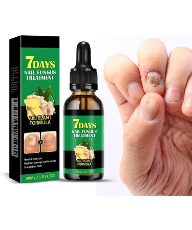 dizhenhui104jiaju LYEAA Nail fungus treatment 7 days nail fungus treatment toenails cuticle care oil ginger nail serum nail strengthening oil for damaged nails 1 piece - Buy Online on GoSupps.com