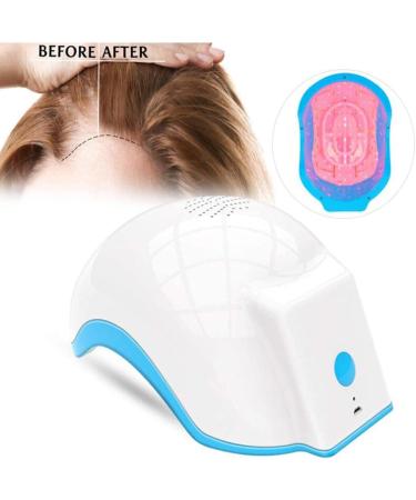 Casque de Croissance des Cheveux Croissance des Cheveux Capuchon Laser Th Rapie Au Laser de Bas Niveau 80 Diodes Laser Traitement de La Perte de Cheveux Favorisant La Repousse des - Buy Online on GoSupps.com
