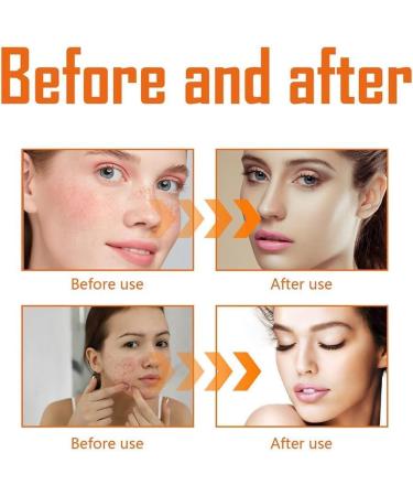 FLLUOUZH West Month Turmeric Toner Dark Spot Eraser Turmeric Toner for Face AntiAging Moisturizing Moisturizing Facial Cleanser Vitamin C and Turmeric Oil Toner Serum for Women 3 Pieces - Buy Online on GoSupps.com