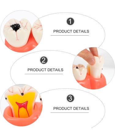 Ultechnovo Dental Recovery Tool Set - 2 Caries Tooth Models for Teaching & Demonstration | 12.5x7x6.5cm - Ideal for Dentistry Education - Buy Online on GoSupps.com