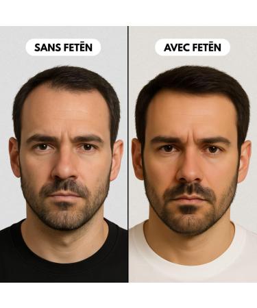 FETEN Set Antichute Homme avec Shampooing 400ml et S rum Spray 100ml Traitement Anti Chute Cheveux Fortifiant Repousse Rapide Lotion Activateur Croissance Hair Growth Cuir Chevelu Peptides Set Serum + Shampooing - Buy Online on GoSupps.com