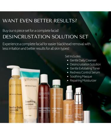 RD ALCHEMY Desincrustation Solution - 4 Fl Oz (Pack of 1) | Scalp Fluid for Pore Softening & Blackhead Removal | Ideal for Professionals & Estheticians - Buy Online on GoSupps.com