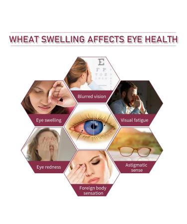 Stye Eye Treatment - Fast Relief for Styes Chalazion & Blepharitis | International Shipping Available - Buy Online on GoSupps.com