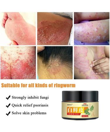 Sensitive Skin Natural Eczema Treatment Cream - Steroid & Fragrance-Free Psoriasis Relief - Anti-Itch & Moisturizing Formula - 1.06oz - Buy Online on GoSupps.com