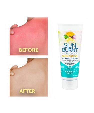 Sunburnt EMCW9 Ultra Hydrating Aloe Vera Gel - 6 oz Clear, SUNB21006 - Buy Online on GoSupps.com