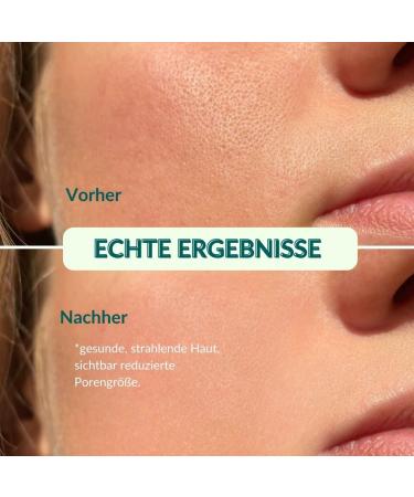 Natural Face Tonic with Organic Aloe Vera & Calendula Vegan Skincare for All Skin Types | Mother Nature Cosmetics - 150ml - Buy Online on GoSupps.com