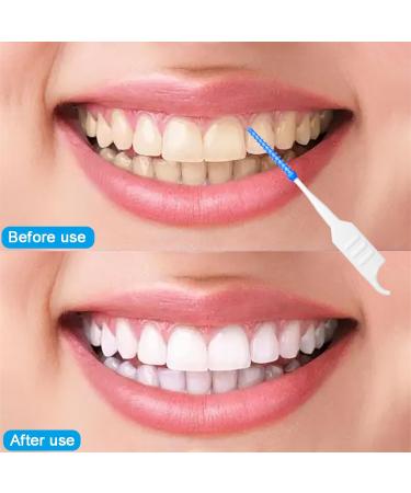 200 Interdental Brushes - Silicone Tooth Cleaning Gaps Set | Narrow Teeth Care | Oral Health Essentials (Blue) - Buy Online on GoSupps.com