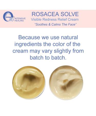 Rosacea Solve Redness Relief Cream - Calming Face Moisturizer for Sensitive Skin - Organic Ingredients with Aloe Vera, Almond Oil, Licorice & Chamomile Extracts - Buy Online on GoSupps.com