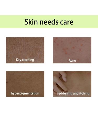 CLY AMS Body Juice Oil Birthday Cake Moisturizes & Firms skin Body Juice Oil Fruit Perfect Beauty Body Juice Oil Hand crafted Body Oil for Women - Buy Online on GoSupps.com